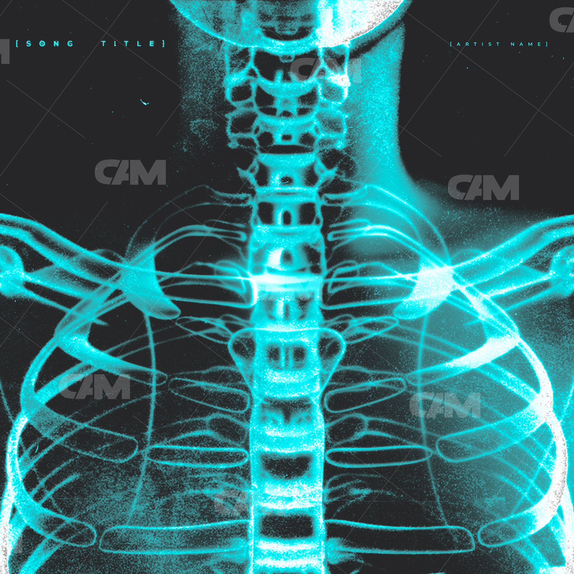 Xray